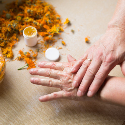 Jemand cremt sich seine Hand mit Bio-Ringelblumensalbe ein.